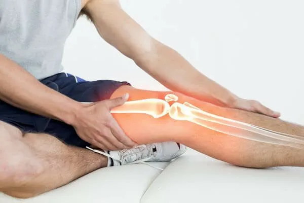 Centro Especializado en Ortopedia 4 1 Esguince de rodilla jpg