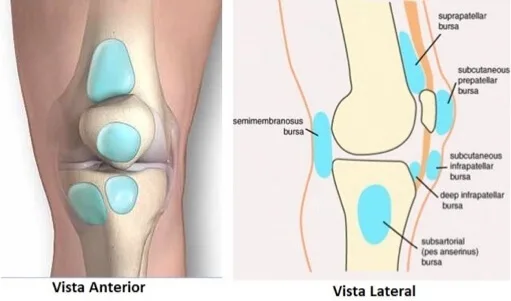Centro Especializado en Ortopedia 15 12 Bursitis de la rodilla jpg