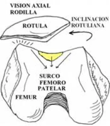 Centro Especializado en Ortopedia 7 4 Condromalacia patelo femoral jpg