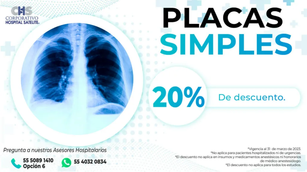 placas simples