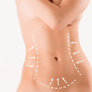 Cirugia estetica y reconstructiva abdomen