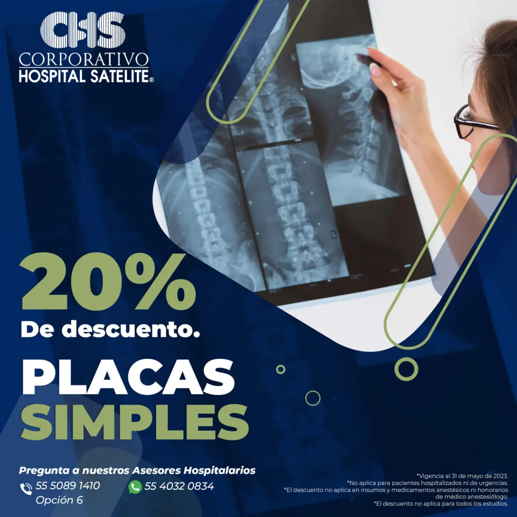 placas